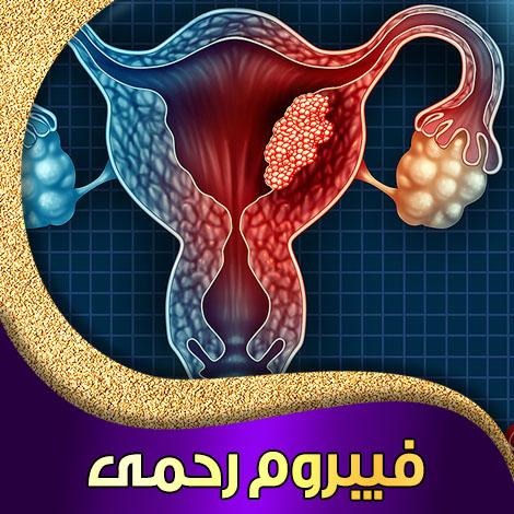 عمل فیبروم بیمارستان دولتی